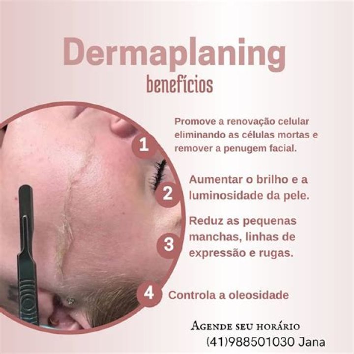 Dermaplaning; o que &eacute; e pra que serve? Sal&atilde;o de Beleza Cravo & Canela
