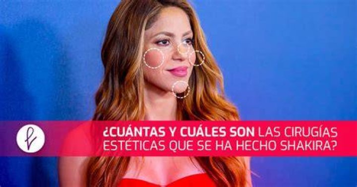 &iquest;Cu&aacute;ntas cirug&iacute;as se ha hecho Cristiano Ronaldo? As&iacute; cambi&oacute; el astro